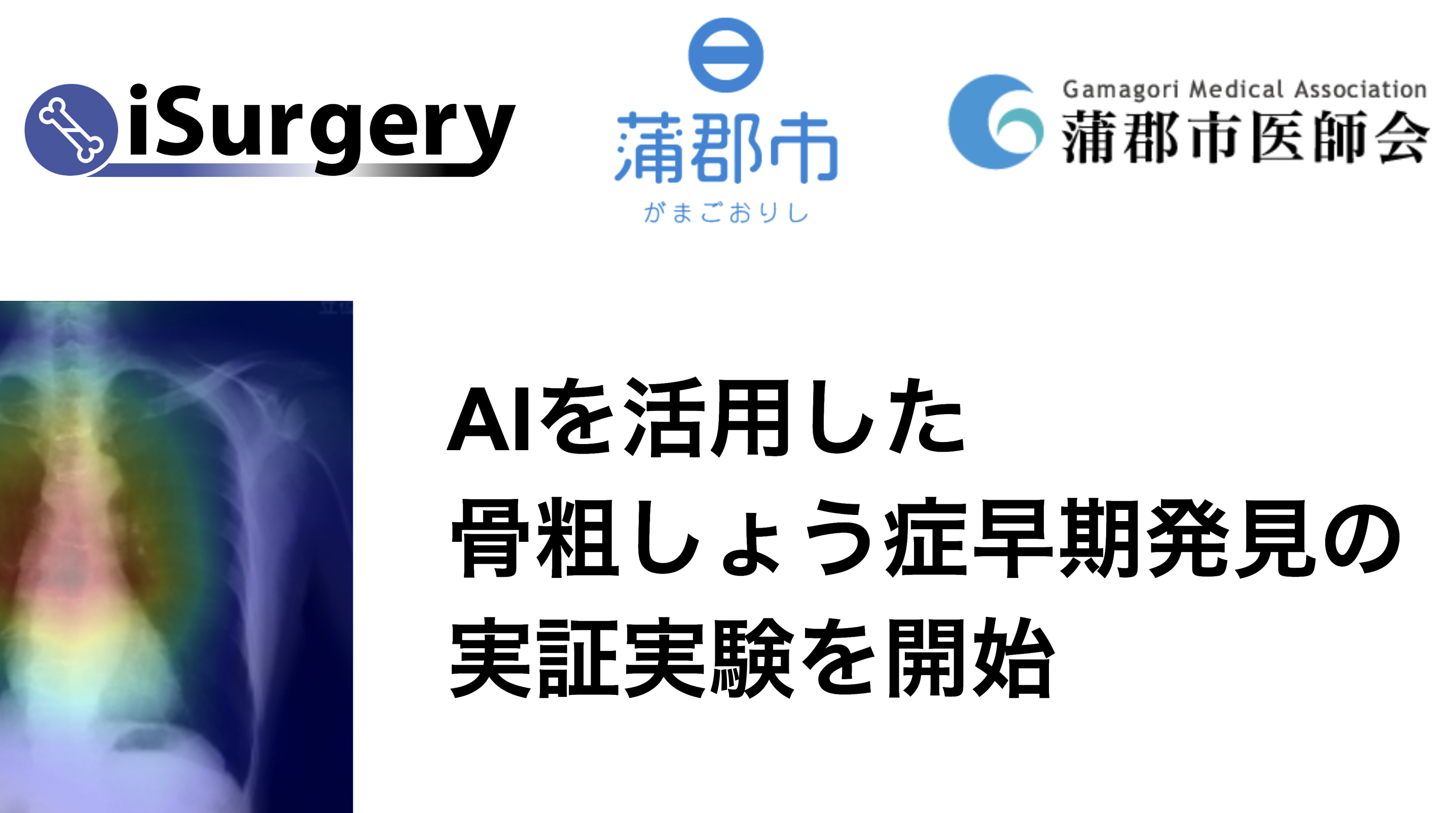 愛知県蒲郡市、iSurgery社とAI×骨粗しょう症の実証実験を開始[ニュース]